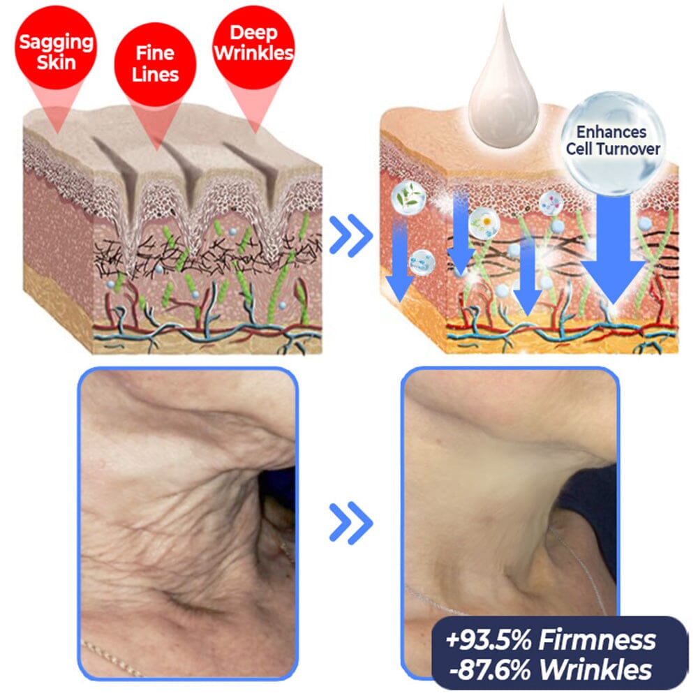 flysmus™ Advanced Tightening & Wrinkles Reducing Lotion (LAST DAY 40% OFF)🌈