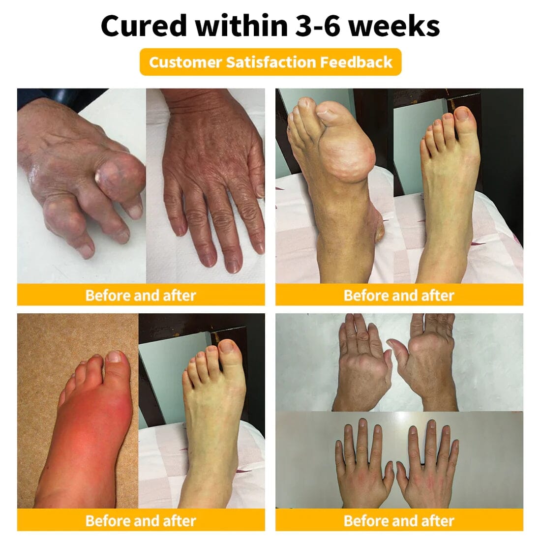 Flysmus™ Bee Venom Pain-Relief Bone Healing Cream🏆LAST DAY SALE 50% OFF 🏆