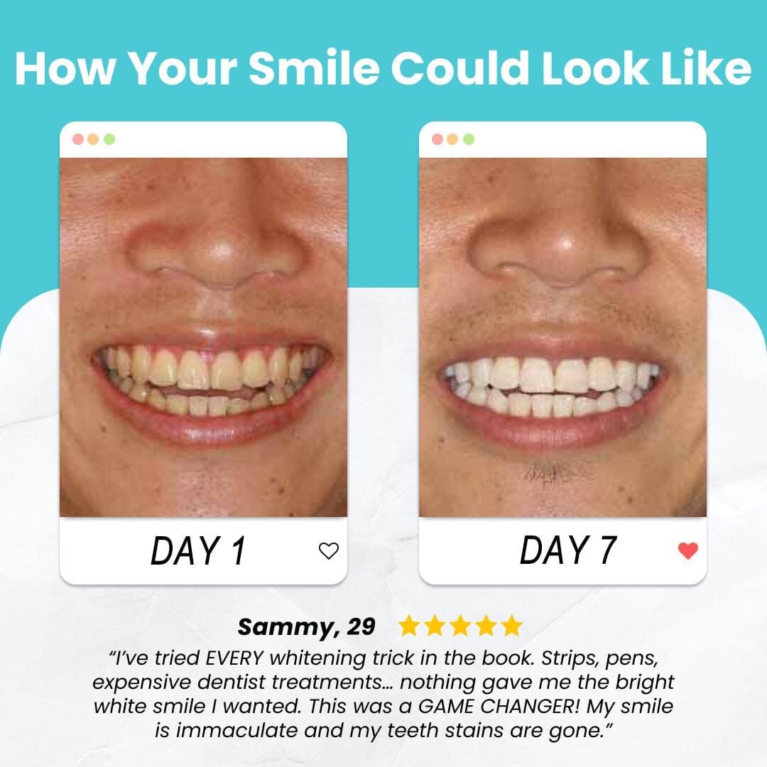Remifa™ SpeedySmile EZBrush 360 U-Shape Toothbrush