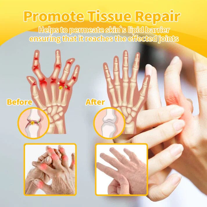 Flysmus™☀️Bee Venom Pain-Relief Bone Healing Cream(Specially for older adults & AOA recommends)