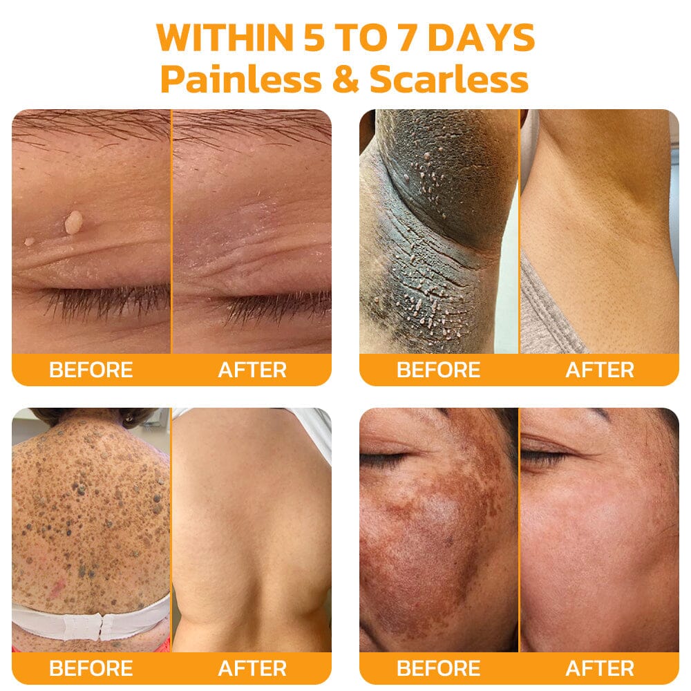 Therapeutic Goods Administration (TGA)✅ Furzero™ Bee Venom Skincare Treatment Pads (⚕️AAD Recommended)