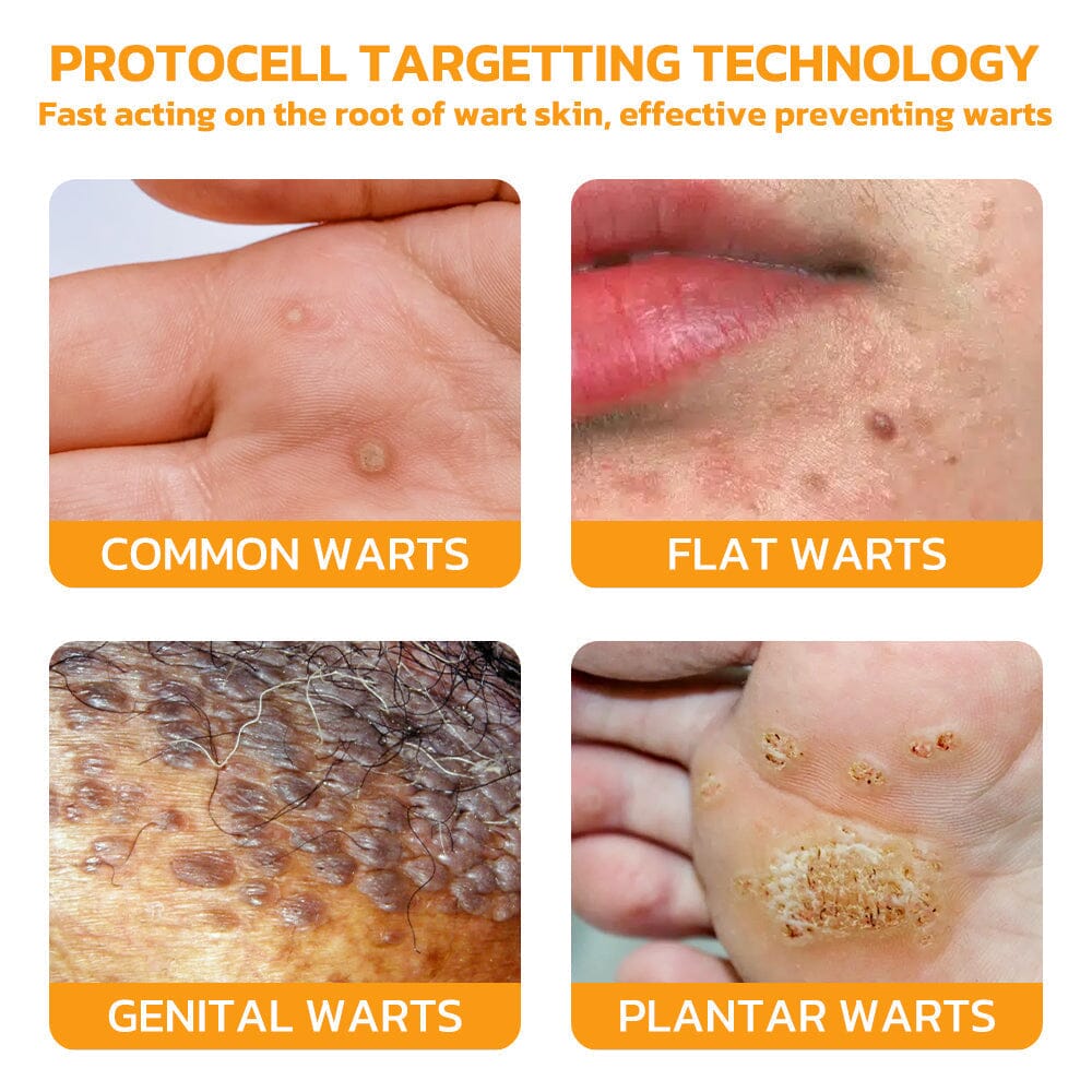 Therapeutic Products Directorate (TPD)✅ Furzero™ Bee Venom Skincare Treatment Pads (⚕️AAD Recommended)