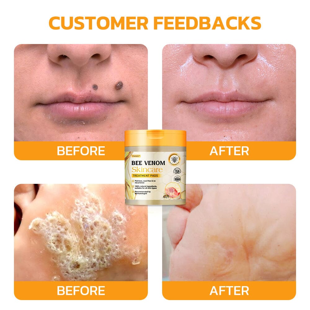 Therapeutic Goods Administration (TGA)✅ Furzero™ Bee Venom Skincare Treatment Pads (⚕️AAD Recommended)