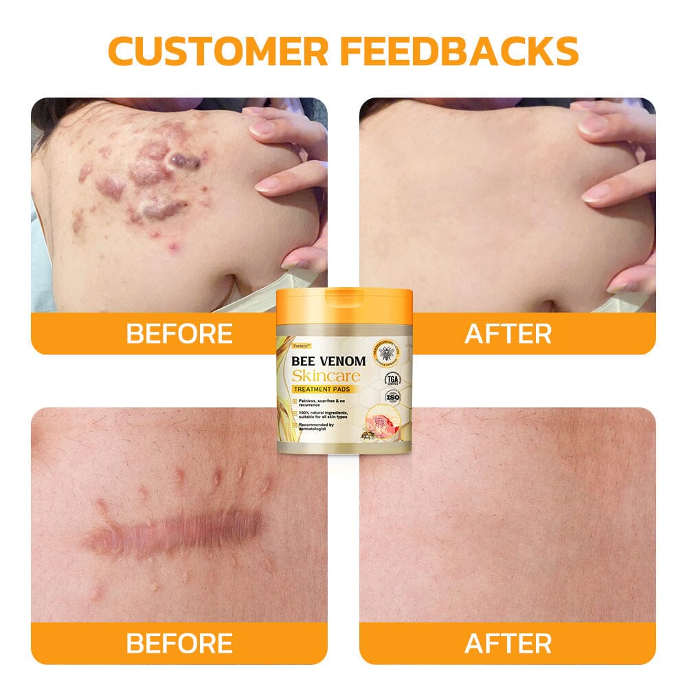Therapeutic Goods Administration (TGA)✅ Furzero™ Bee Venom Skincare Treatment Pads (⚕️AAD Recommended)