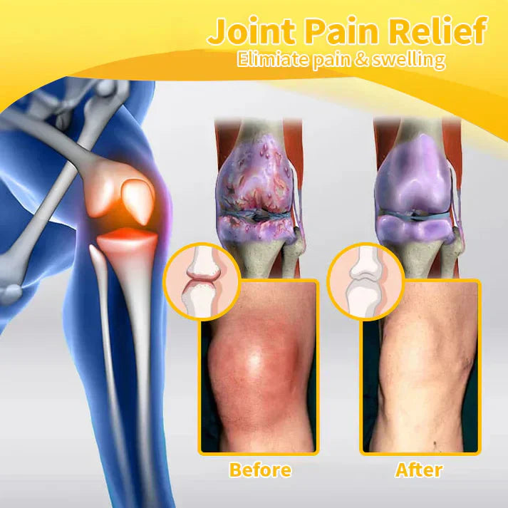 ✅Official Store: flysmus™ Bee-Venom Pain-Relief Bone Healing Cream👨‍⚕️UK Osteopathic Medical Association （BOA）Approved(Reducing joint swelling, pain, stiffness, redness, warmth, soreness, and joint fatigue)