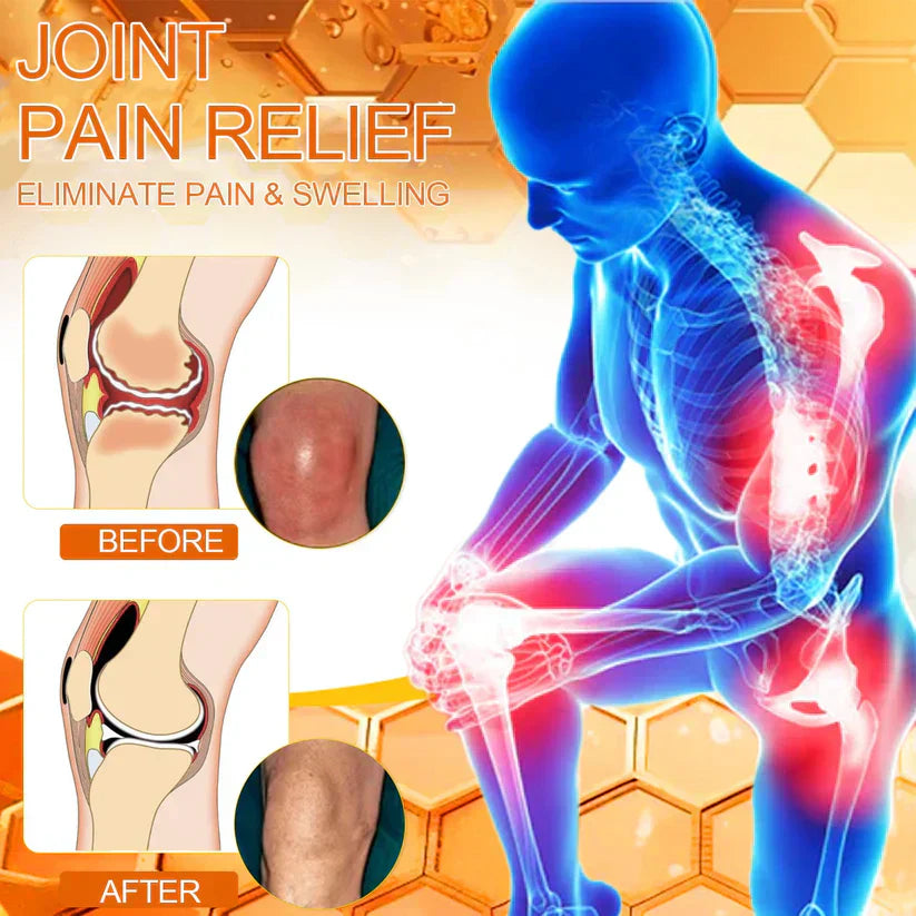 ✅Official Store: flysmus™ Bee-Venom Pain-Relief Bone Healing Cream👨‍⚕️UK Osteopathic Medical Association （BOA）Approved(Reducing joint swelling, pain, stiffness, redness, warmth, soreness, and joint fatigue)