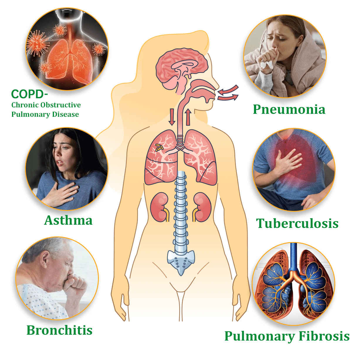 💜✅Official Store:Ourlyard® Herbal Lung Cleansing Inhaler👨‍⚕️FDA Certification(💝 Cough, wheezing, shortness of breath, sputum, stuffy nose, bronchitis, bronchitis, allergy symptoms, lung discomfort💝)